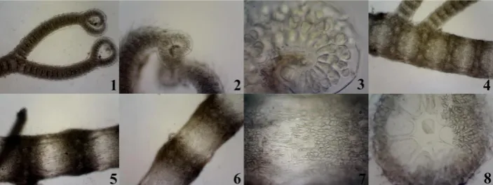 Figure 14.  C. virgatum 1-2: Thallus upper part (4x), 3-4: Non-tetrasporous filament and tetrasporous filament (10x), 5: Irregular tetraspores in the cortex (40x), 6-8: Cystocarps surrounded by ramuli (4x), 9: Thallus cross-sectional, central and pericentr