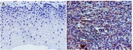 Table 1. The correlation of CCN3 expression with clinicopathological parameters in 56 cervical cancer specimens