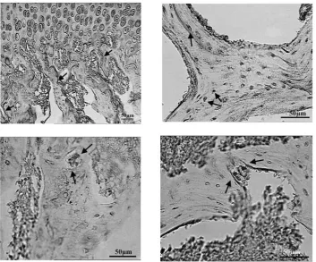 Fig. 3. A) Expression of SNA receptor sites in the chondro-osseous junction of a male guinea pig 3 months of age;  B) RCA labeling of osteocytes within bony lacunas in a male guinea pig 3 years of age; C) PNA receptor sites within the cytoplasm of an osteoclast in Howship’s lacuna in a female guinea pig 3 years of age; D) SNA binding to osteo-clasts in a male guinea pig aged 1 year