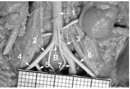 Fig. 1. The abdominal aorta and iliac arteries in a female fetus aged 24 weeks: B – aortic bifurcation, 1 – abdominal aorta, 2 – right common iliac artery, 3 – left common iliac artery, 4 – right external iliac artery, 5 – right internal iliac artery, 6 – left external iliac artery, 7 – left internal iliac artery