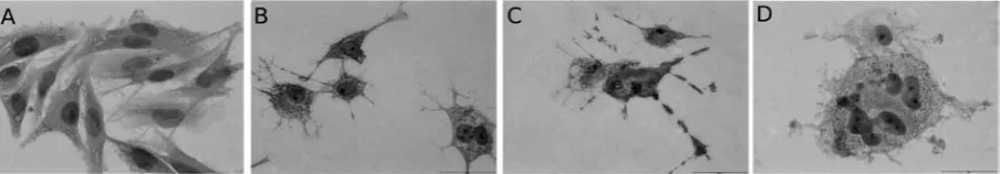 Fig. 2. The intracellular distribution of: A) Ph in Me45 cell line after 18 hours of incubation; B) Mito-Tracker green in Me45 cell line after 15 minutes incubation; C) Co-localization of Ph and Mito-Tracker green in Me45 cell line