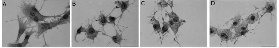 Fig. 4. The HO-1 expression in Me45: A) control cells; B) cells after 3 h incubation after Ph-PDT (clight dose 6 J/cmPh = 20μg/ml and 2); C) cells after 6 h incubation after Ph-PDT (cPh = 20 μg/ml and light dose 6 J/cm2); D) cells after 24 h incubation after Ph-PDT (cPh = 20 μg/ml and light dose 6 J/cm2)
