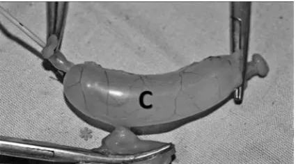 Fig. 4. Mechanical burst pressure testing of the colos-tomy (asterisk) (C – colon)