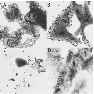 Fig. 1. Adherence patterns of the E. coli strains examined. A) aggregative adherence (AA); B) diffuse adherence (DA); C) cell-detaching pattern (CDT); D) undefined adherence pattern (UD)