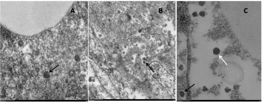 Figure 4. Electron micrograph of infected liver from diseased fish.  Fully formed virions had an outer membrane and electron dense core (black arrow)