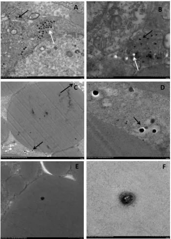 Figure 5. Electron micrograph of infected tissues and eggs from a naturally infected Carassiusauratus