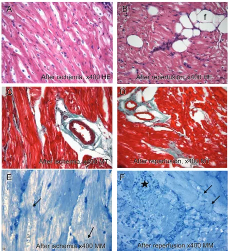 Fig. 5. In nitrite groups micrographs, cytoplasms of cardiomyocytes appear pink at A and B, red at C, and D and blue in color at the E and F