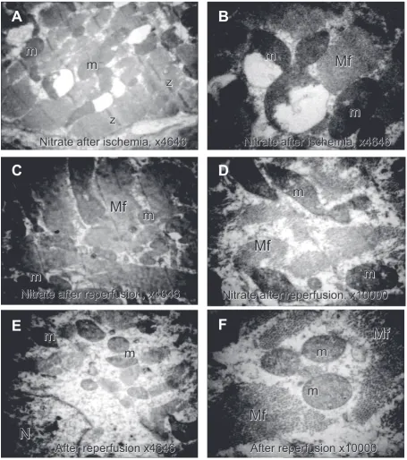 Fig. 8. The control nitrate groups electron micrographs are presented. At A and B giant mitochondria (m) with dete-riorated cristae and disrupted membranes are noted after ischemia with nitrate