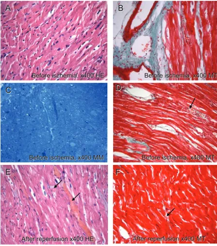 Fig. 4. In control group micrographs, cytoplasms of cardiomyocytes are pink at A and E, red at B, D and F and blue in color at the C