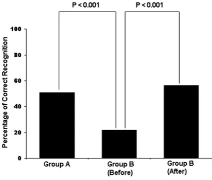 Fig. 2. Mitral stenosis