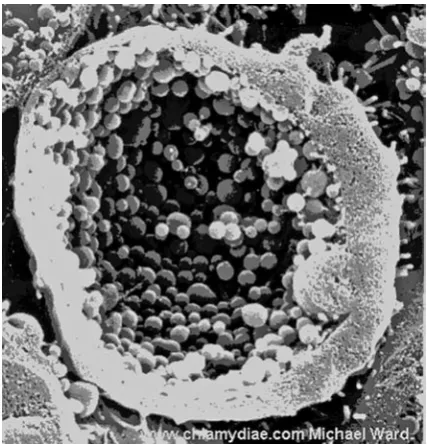Fig. 3. The disintegration of the epithelial cells of the host and the release of elementary bodies