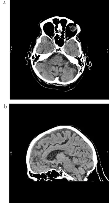 Fig. 9. Axial and sagittal CT brain images obtained with DECT: a) axial brain image, b) sagittal brain image