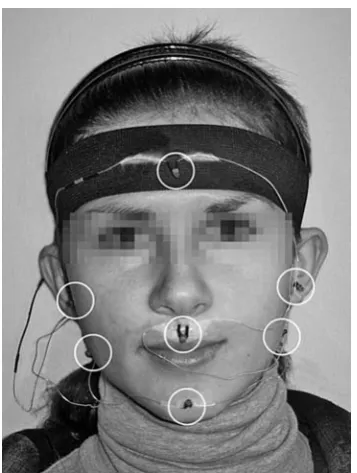 Fig. 7. Positions of LED markers on the angles of the jaw and protuberantia mentalis