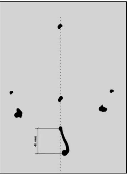 Fig. 12. Example analysis of one patient’s movement trajectory during abduction of the jaw (frontal plane)