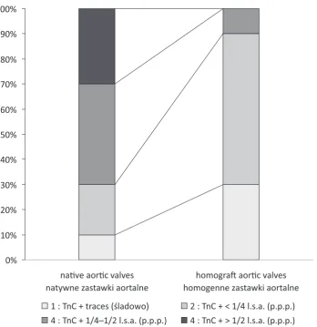 Fig. 2. TnC (red) in native stenotic aortic valve leaflet. a: immunoreactivity in the leaflet stroma and segmen-tally along the surface in a basal lamina-associated zone; b: high immunoreactivity in the vicinity of focal calci-fications (asterisk); c: immu