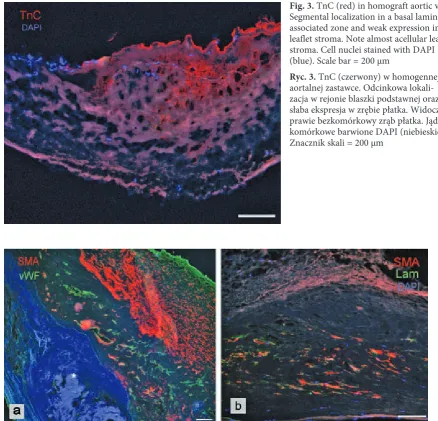 Fig. 3. TnC (red) in homograft aortic valve. Segmental localization in a basal lamina-associated zone and weak expression in leaflet stroma