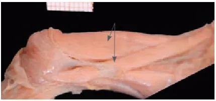 Fig. 10. Muscle fragment partial duplication
