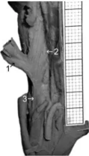 Fig. 4. Regression line for the width (y) of the long heads (right and left) versus fetal age (x)