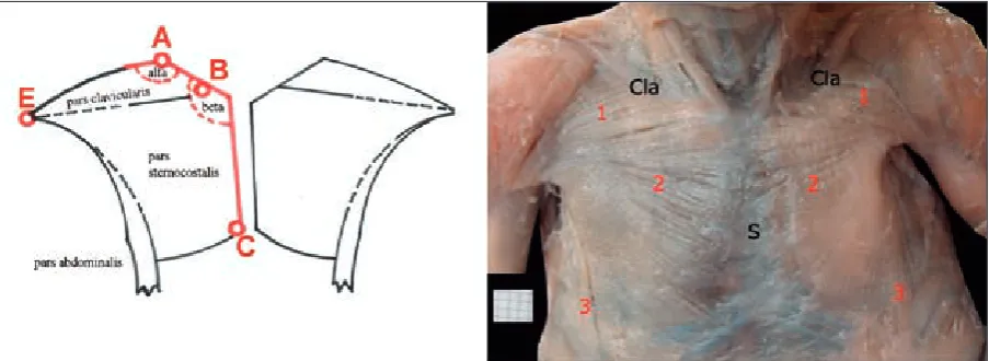 Fig. 1. The scheme of notations used in pectoralis major muscle measurements and an example of PMM dissection from a six-month female fetus