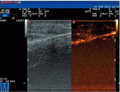 Fig. 5. Longitudinal section through the knee joint. Image on the left was obtained using traditional ultrasonography