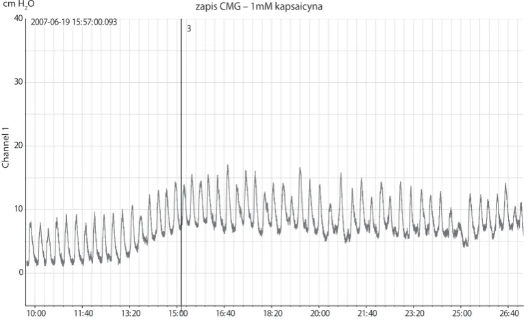 Fig. 1. Cystometrogram of healthy rats (group 1). The figure shows a 15-minute interval (horizontal axis)