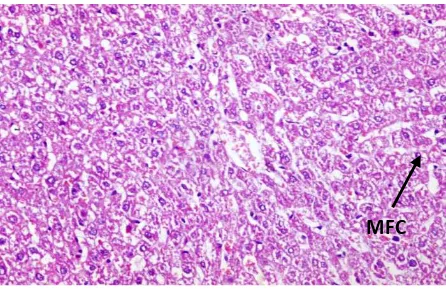 Fig. (15): Cross section of mice liver of group (7) treated with (NaF +selenium+ Curcumin extract) (10.3mg/kg),(0.5 mg/kg) & (60 mg/Kg)  respectively showing moderate fatty changes in the hepatocytes (H and E x 200) (MFC: Moderate fatty change)  