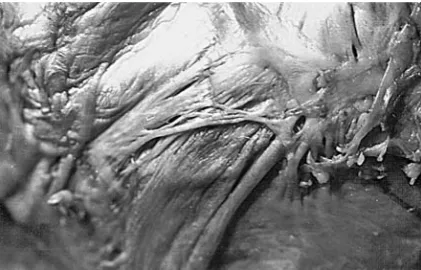 Fig. 24. Specimen photo. Flat arc in the frontal area with a “beam”