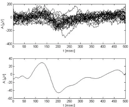 Fig. 1. Single-trial electrical brain responses evoked by the same visual stimulus, hidden in the spontaneous brain activity (EEG) and random noise (graph one)