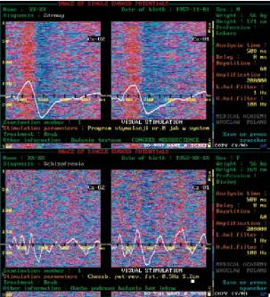 Fig. 2. Method of presentation of single brain responses in the form of colour images comprising lines (each line in the picture correspond to one single-trial), whose ampli-tude is matched by the colour scale