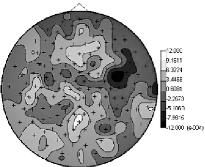 Fig. 3. Coefficients of trends matched to the estima-tor of amplitude variability α (3) for the P100 wave of single evoked response administrated to one ear by means of sound at the frequency of 1 kHz