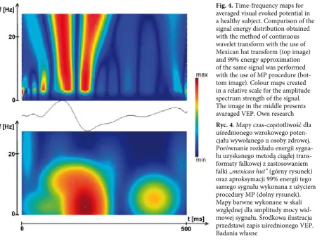 Fig. 4. Time-frequency maps for averaged visual evoked potential in a healthy subject