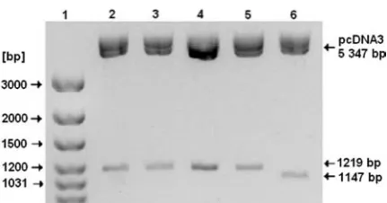 Fig. 2. Electrophoretic separation of digestion plas-mids extracted from five transformant clones