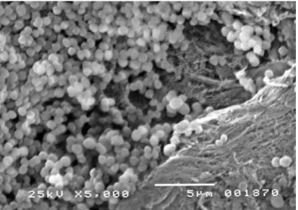 Fig. 1. Biofilm on the surface of a multifilament poly-ester mesh (S. aureus); scanning electron microscopy (magnification 5000×)
