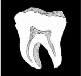 Fig. 6. Reconstructed 3D representation chamber and canals of A2 teeth