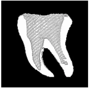 Fig. 9. Reconstructed representation external and inner space of A2 teeth after endodontic preparation