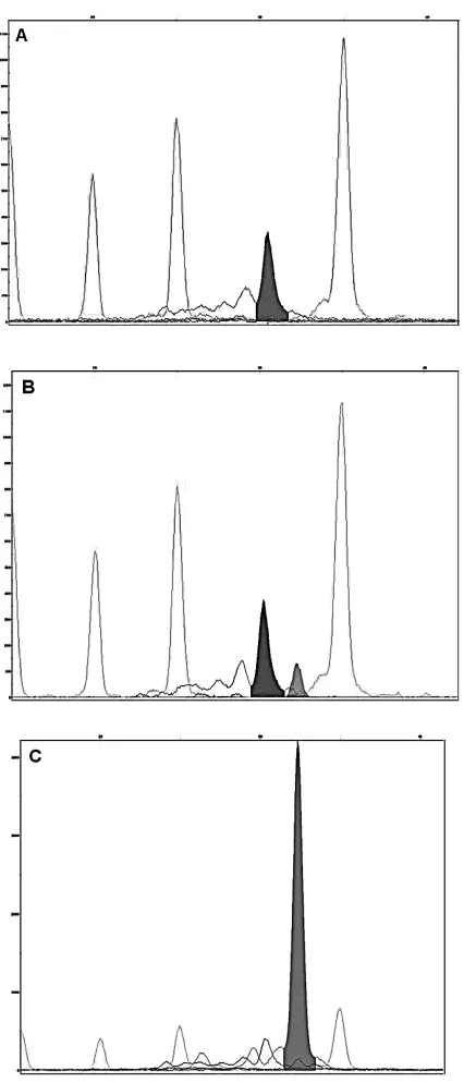 Fig. 1. Examples of electrophorograms for FOXA1G559A polymorphisms determined by SNaPshotgenotyping