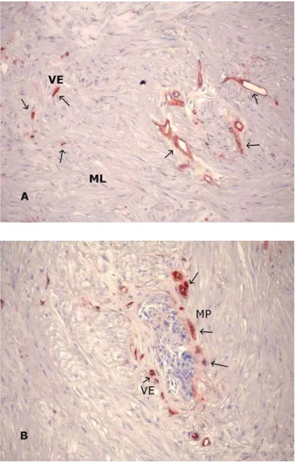 Fig. 2. CD34 immunohistochemical staining. CD34in vascular endothelial cells in specimens from bothcontrol (A: arrows) and IHPS patients (B: arrows,original magnification ×immunoreactivity was not observed in the myentericplexus or pyloric muscle in specim