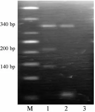 Fig. 2. Representative examples of CYP1A1 m1 poly−morphism analysis. Lanes: M – DNA marker ladder; 1 – CYP1A1 w1/m1; 2 – CYP1A1 w1/w1; 3 – water