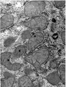Fig. 1. CHC, ablong highly energized mitochondria,some of pituitary shapes (arrow, × 15 000)