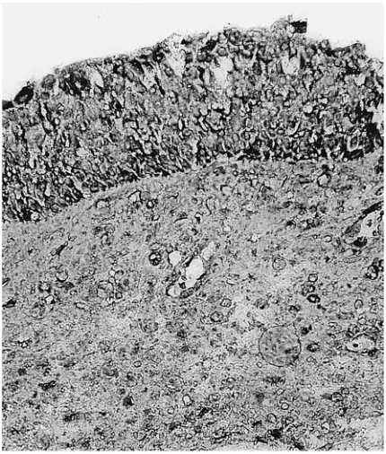 Fig. 3. Weak (+) bFGF expression in epithelial andendothelial cells of normal mucosa, magnification is ×400