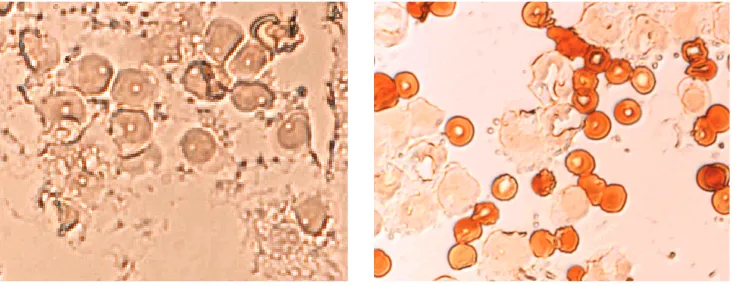 Fig. 1. iNOS expression in peripheral blood leukocyte: A – control group, B – RA subjectRyc