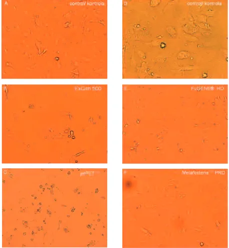 Fig. 1. Morphological changes occurring in HUVECs after exposure to polyethylenimine or lipid transfection reagents.Transfected HUVEC cultures show different degrees of changes in morphology (spherical shape) as a result of thestressful effects exerted by 