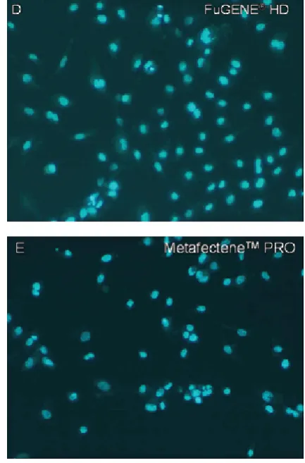 Fig. 2. Viability of HUVECs following exposure topolyethylenimine or lipid complexes analyzed by fluo−rescence microscopy