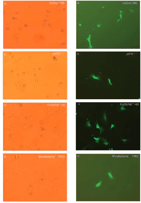 Fig. 4. Efficiency of LPEI and lipid transfection reagents in the HUVEC line assessed under white and fluorescentlight