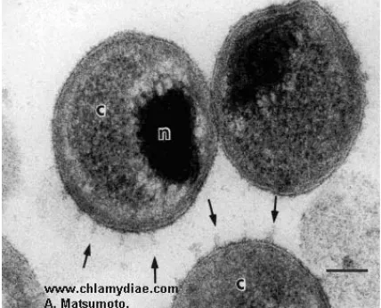 Fig. 1. Chlamydia pneumoniae phases of developement