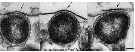 Fig. 3. Reticulate body [14]