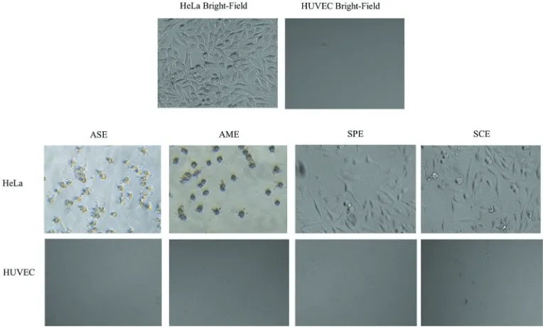 Figure 2. Cytotoxic assay of macroalgae crude ethanol extracts in HeLa and HUVEC cells analysed with MTT assay in 72h treatment.