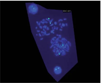 Fig. 2a. Fluorescence with the TUPLE1 Region Probe (22q11.2) and ControlProbe (22qter)