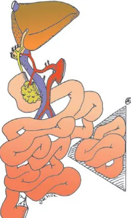 Fig. 3. En−bloc reduced combined liver and small
