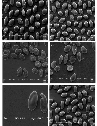 Figure 2.  Scanning electron micrographs of erythrocytes from treated fish showing: (A) crenated cell (CR), irregular shaped cell (IR) at 0.040 mg/L, 30d; (B) spherocytes (SP) increased in number, lobopodial projection (LB) at two or more points (0.020 mg/
